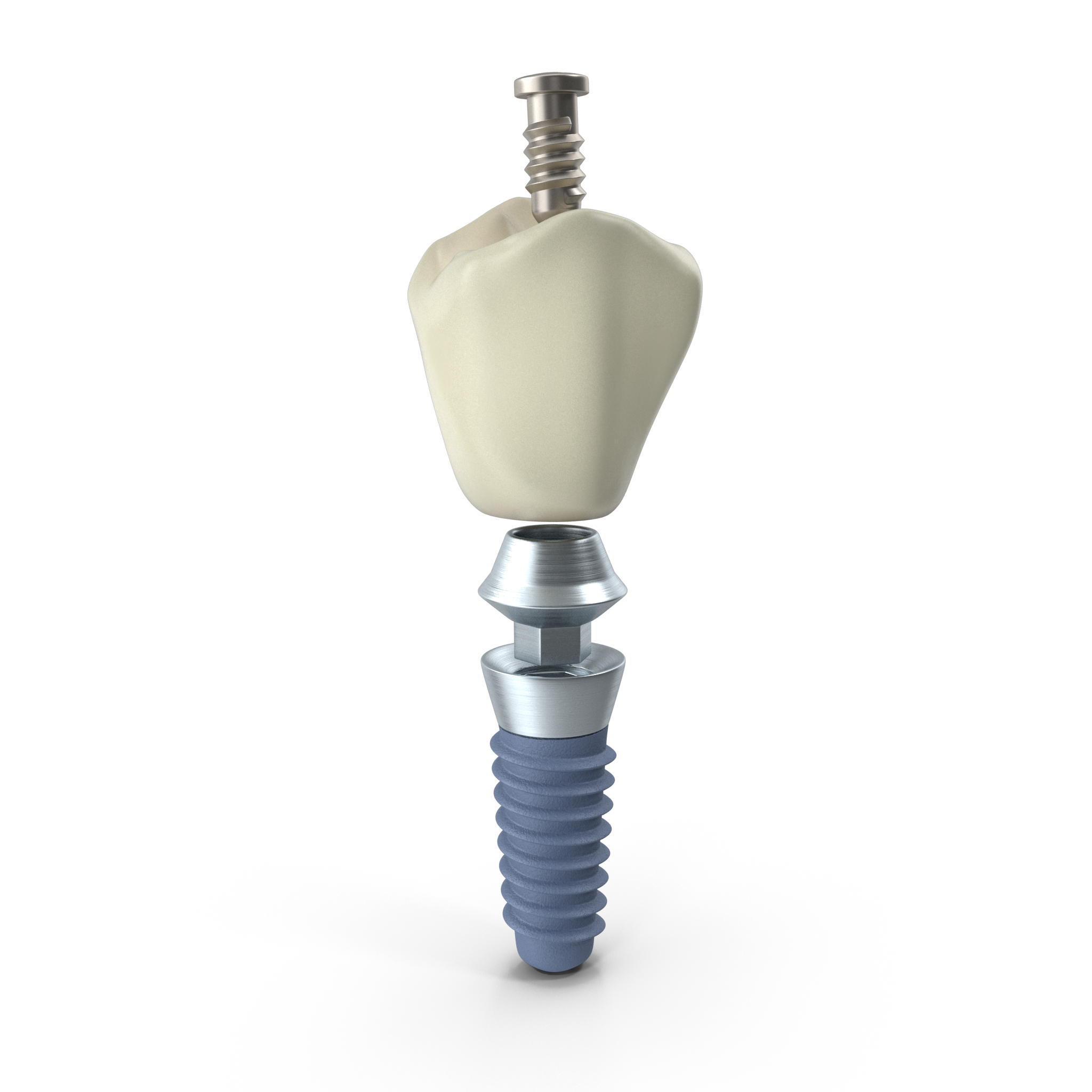 Anatomia implantu. Z czego składa się twój "nowy ząb"? | Komplet Stomatologia 