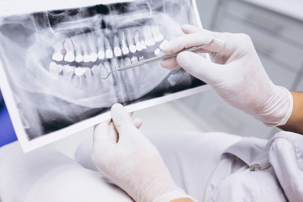 Metody leczenia zębów