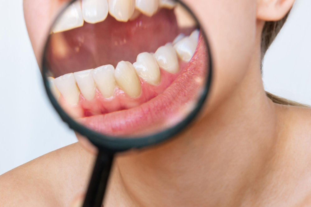 Leczenie periodontologiczne: Walka z chorobami dziąseł i przyzębia