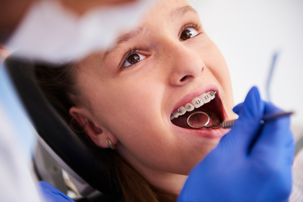 Ortodoncja dla dorosłych: Proces i korzyści prostowania zgryzu