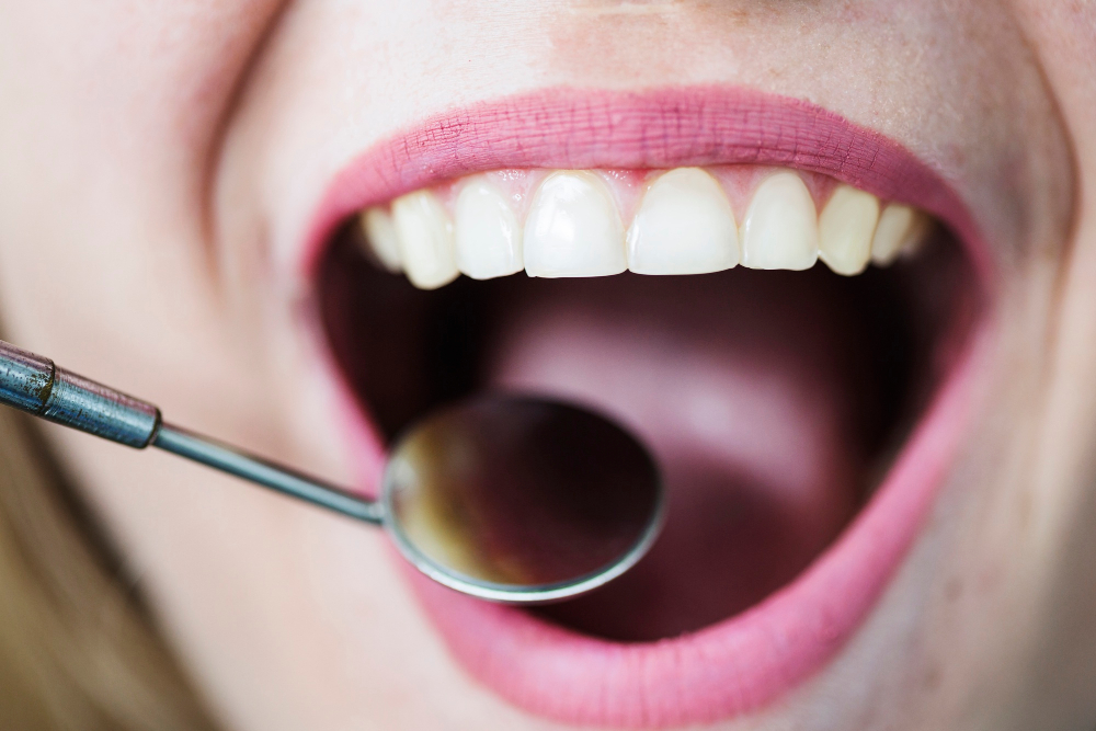 Wizyty profilaktyczne u dentysty: Jak dbać o stan zdrowia jamy ustnej?